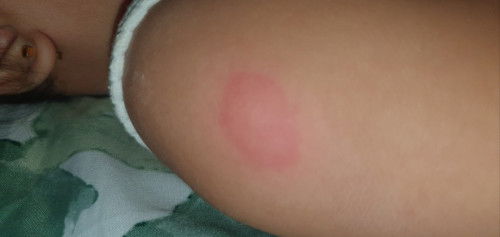 Pwede ba ulit mahawa si baby sa ubo na sa kanya din nagumpisa?