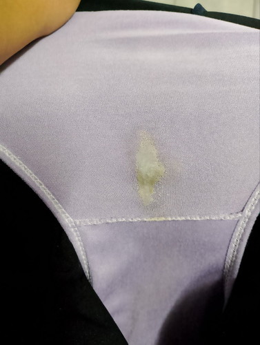 ตกขาวสีเขียว