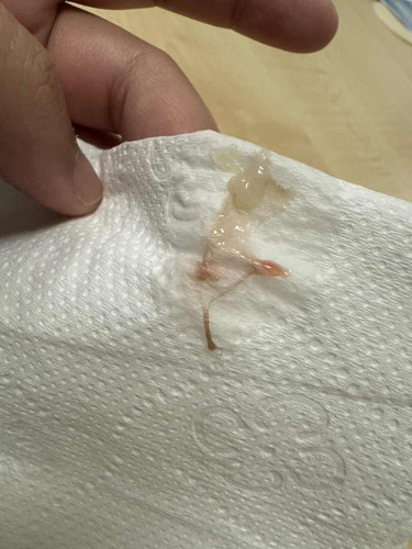 Bleeding 7w