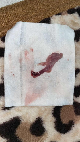 แบบนี้แท้งมั้ยคะ