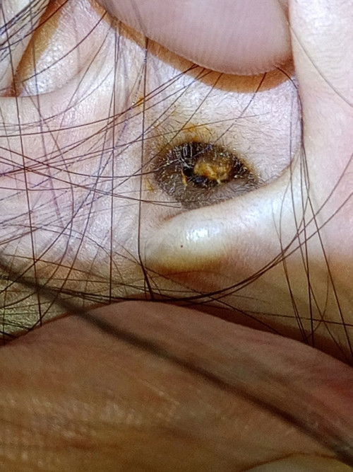 Tak sedar anak masukan kertas dalam telinga