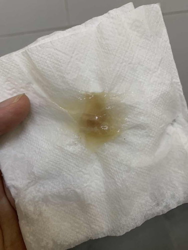 mucus plug atau tak?