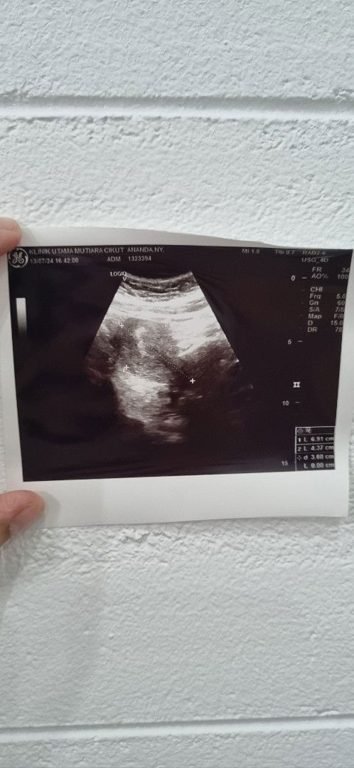 Aku Hamil atau Tidak ya?