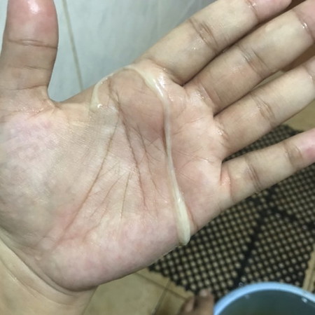 mucus plug
