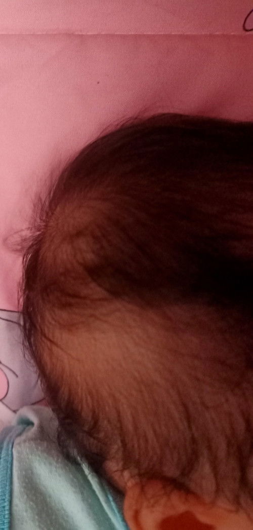 hello mga mhie normal lng ba sa baby na nagiging manipis yung buhok? dati po Kasi makapal yung buhok