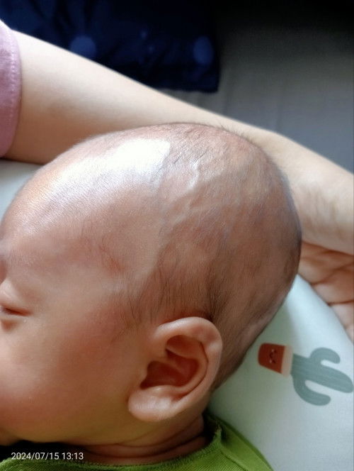 Bagaimana caranya agar kepala baby bulat