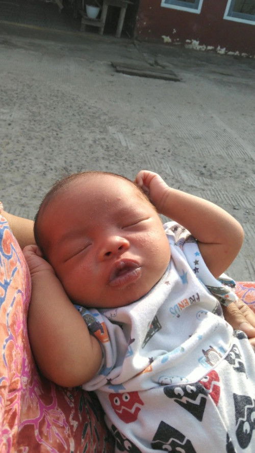 bruntusan d muka bayi