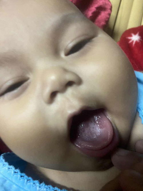 ลิ้นลูกน้องขาว