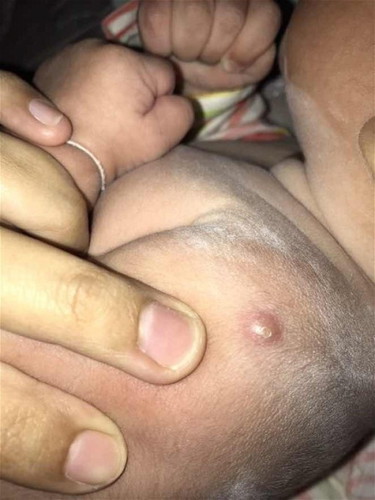 กังวลมาก กลัวน้องเจ็บ😵💫