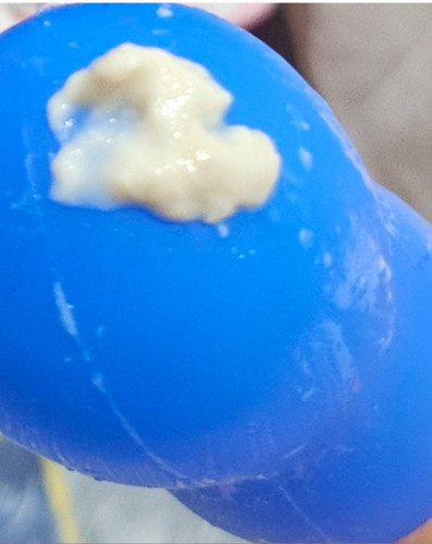Is this mucus plug or just really thick discharge?