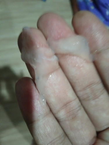 คืออะไรคะเป็นแบบนี้