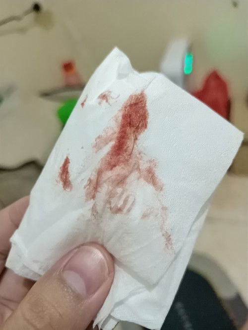 Nifas Selama 2 Bulan Lebih