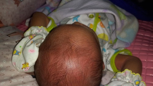 Kepala bayi tidak rata