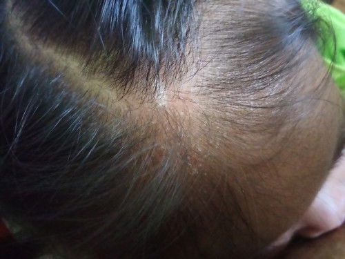 Ini knp ya bun ada yg tau ga? Apa ga cocok sampo?