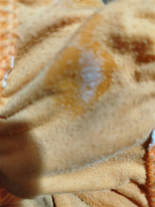 17 weeks preggy . normal po ba ito???? 
discharge q po yan.