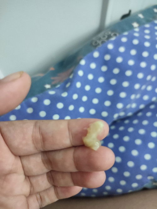 Apakah tanda2 persalinan?