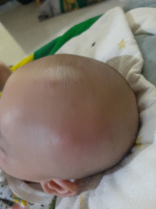 bun mau tanya deh ini normal atau engga ya