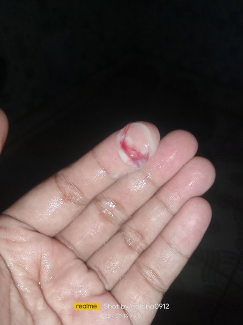 Ini tanda persalinan bukan ya?