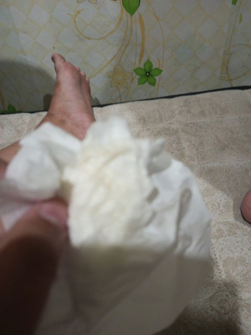 Keluar cairan putih susu