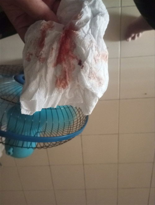 กระตุ้นปากมดลูกรอบที่2