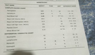 Anemic po kaya ako ano po kaya ibigsabihin ng test ko na po na ito salamat po sa sasagot
