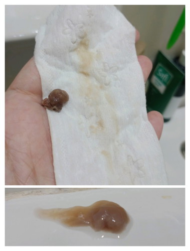 Brown Discharge
