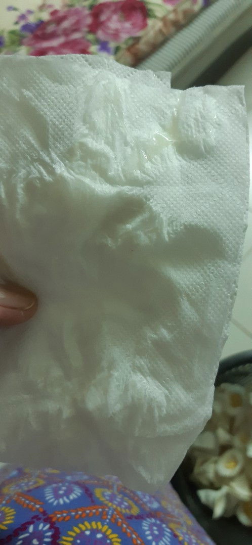 มีมูกแบบนี้ออกมาคือไรคะ ?