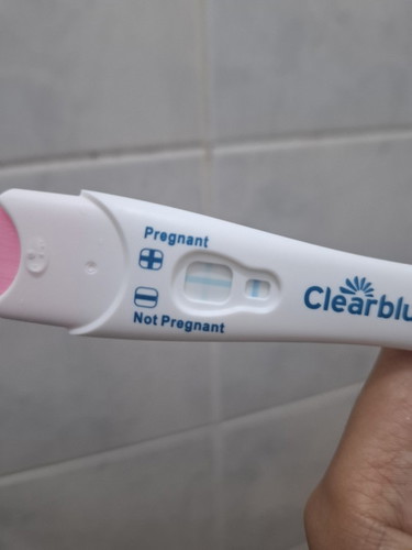 Miscarriage