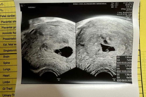 เรายังมีความหวังจะเจอน้องอยู่มั้ยคะ