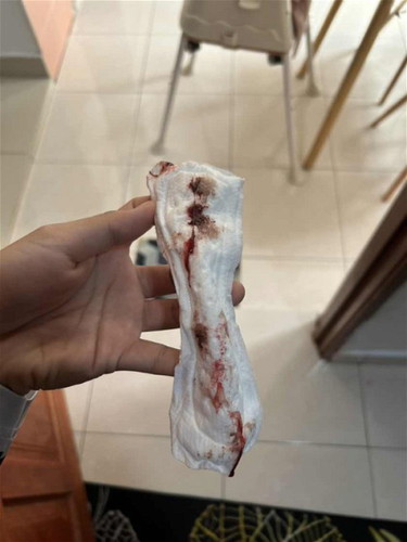 Bleeding week 8