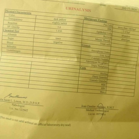 urinalysis