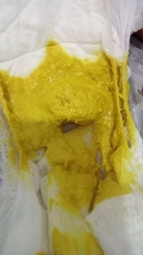 Bayi 3 bulan 13 hari