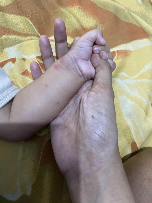 ini bintik bintik apa ya?