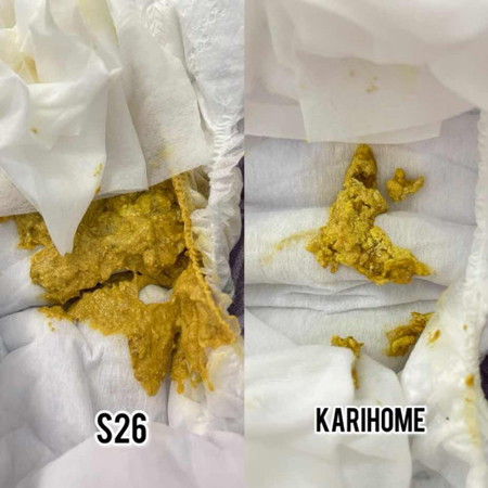 Mana najis yg normal ye ?