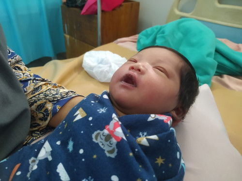 Berhasil vbac padahal sudah dijadwalkan SC