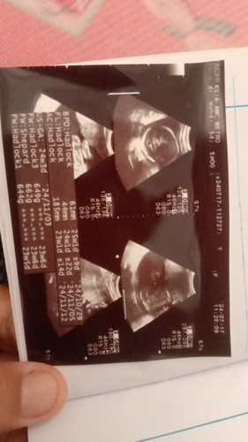 Assalamualaikum,mau tnya dong Bun usia kandungan 27minggu BB bayi msh 600gram kira2 normal gk Bun?