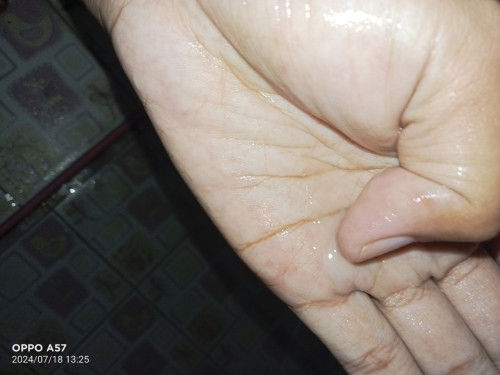 ตอนนี้ตั้งครรภ์ได้ 20 Week มีอะไรไหลออกมาคล้ายๆมูกใสๆ อันตรายไหมค่ะ