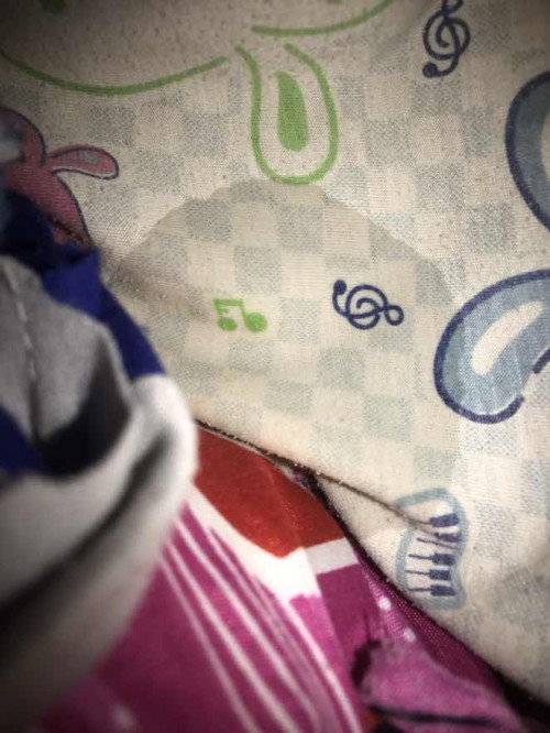 มีน้ำขาวคุ้นไหลออกจากเต้านม