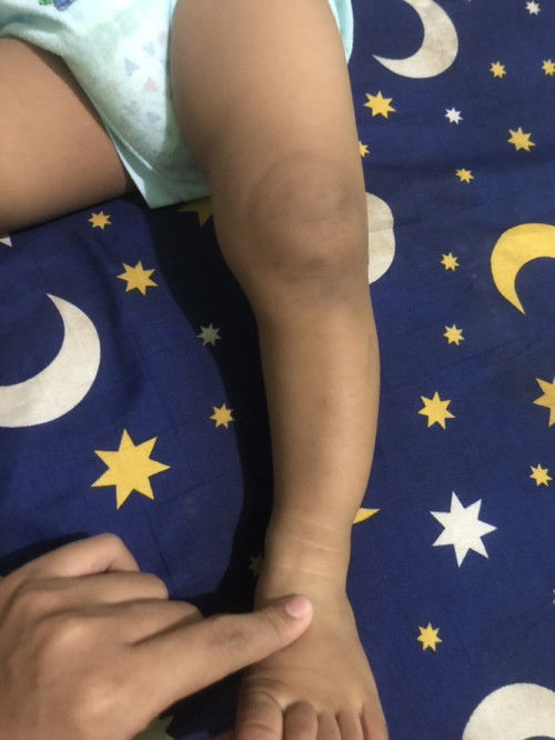 Kaki bayi 11bulan