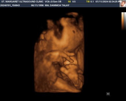 Normal ba ang pananakit nito?