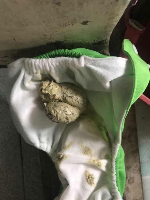 Toodler poop 2 yr old formula-fed baby