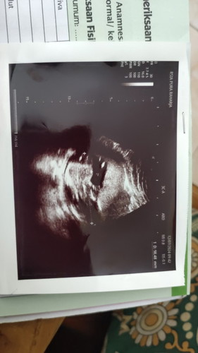 Mohon izin bun, dan tolong bantu apa ada yg bisa bantu saya buat baca hasil usg soalnya dokter cuek