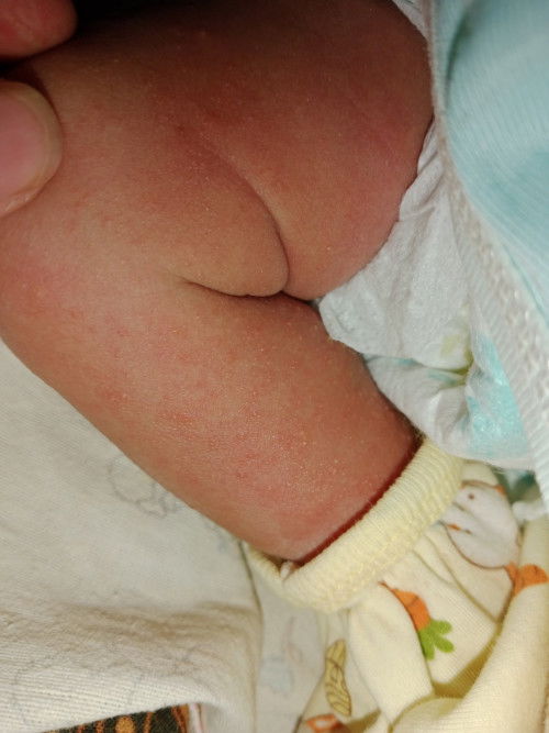 Bun mau tanya ada yang bayi nya pernah ngalamin kayak gini gak? Terus gimana ya cara mengatasi nya