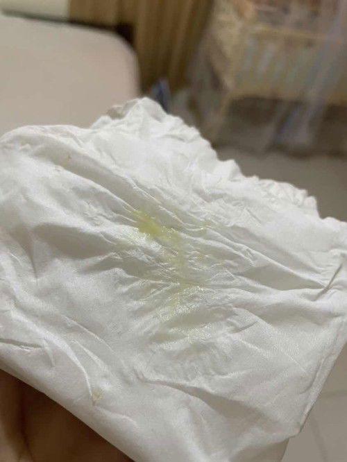 Normal lang ba to mga mhie?