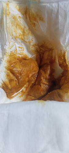 Saya mau menanyakan anak saya bab nya beda kayak. Biasa nya apa obat nya ya bun???