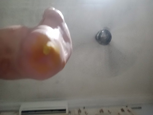 Ketuat kat kaki / foot corn