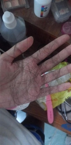 แม่ๆผมร่วงกันตั้งแต่กี่วีคคะ เราร่วงตั้งแต่9วีคปกติมั้ยคะ