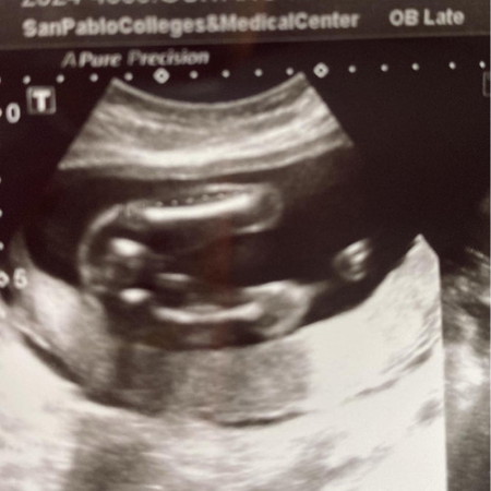 Gender ni baby 20 weeks