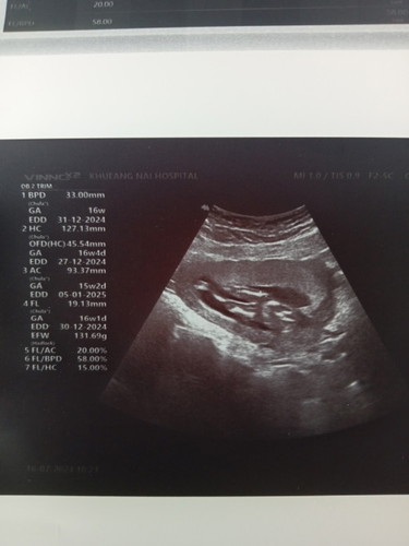 ขอสอบถามเเม่กันคะ