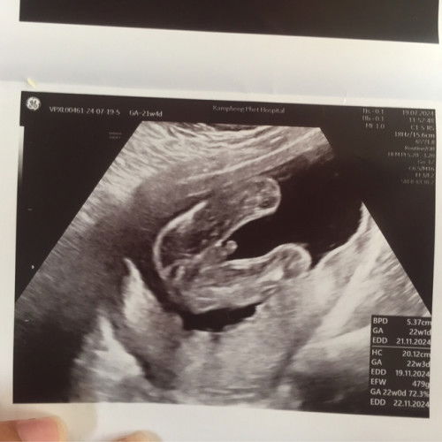 ป้าหมอขอดูหน้าไห้ดู จู๋ น่าเอ็นดูจิงๆ❤️👶🏻

#ไอ้ดื้อน้ำหนักเกินเกณฑ์รักหนูที่สุด👦🏻👦🏻